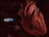The Last Heart